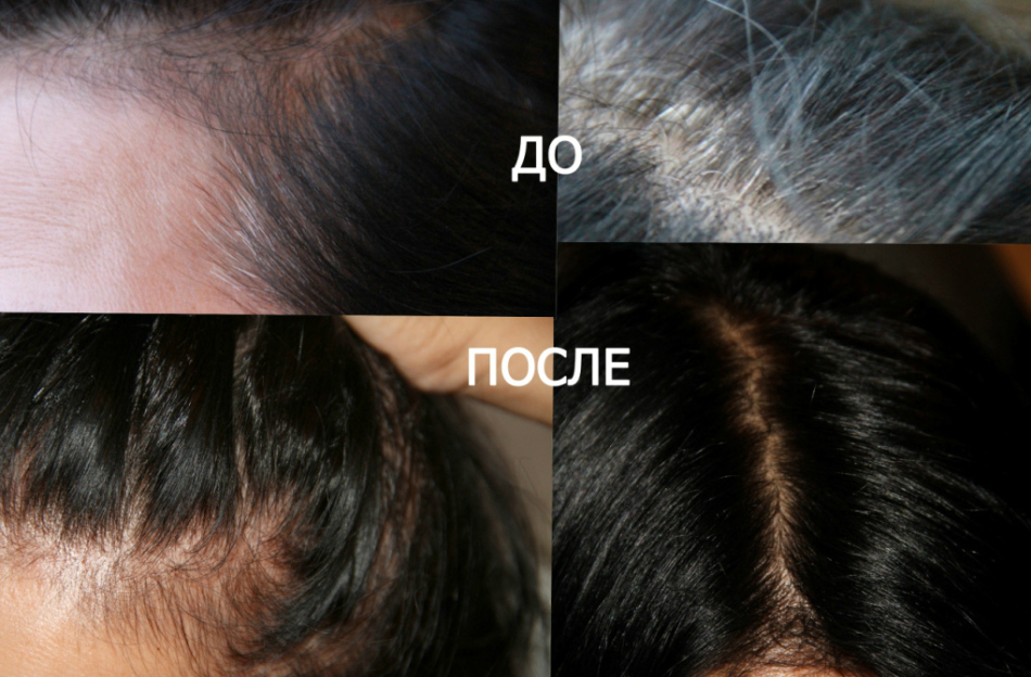 Фото-коллаж волос с сединами до и после окрашивания басмой в черный цвет